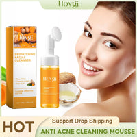Turmeric Foam Cleanser Anti-Acne, Oil Control & Brightening Face Wash